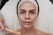 Morpheus8: The Complete Guide | Kate Somerville Clinic – Kate Somerville US