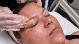 What It Is, Recovery, Cost & Skin Benefits – Kate Somerville US
