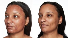 The Secret to Firmer, Younger-Looking Skin – Kate Somerville US
